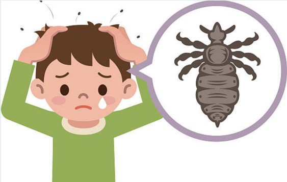 وصفات طبيعية فعالة للقضاء على القمل