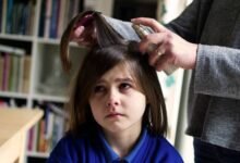 وصفات طبيعية فعالة للقضاء على القمل.