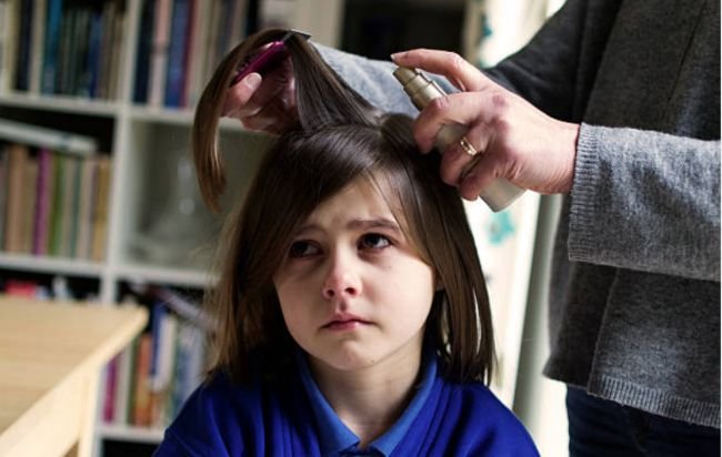 وصفات طبيعية فعالة للقضاء على القمل.